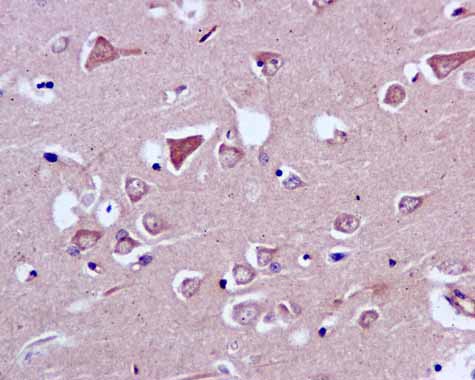 ab166892 showing +ve staining in Human normal brain.