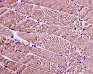 Immunohistochemical analysis of paraffin embedded Human muscle tissue labeling CAPZA1 with ab166892 at 1/100 dilution.