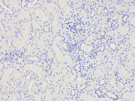 Immunohistochemistry (Formalin/PFA-fixed paraffin-embedded sections) analysis of human kidney tissue labelling CAPZA2 with ab175378 at 1/200. Magnification: 400x.