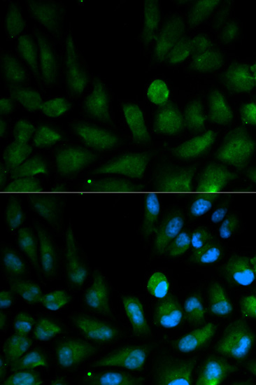 Immunocytochemistry/Immunofluorescence analysis of HepG2 cells using ab175378. Blue DAPI for nuclear staining.