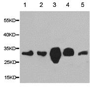 All lanes : Anti-CAPZA2 antibody (ab175378) at 1/500 dilutionLane 1 : HeLa lysateLane 2 : THP1 lysateLane 3 : 22RV1 lysateLane 4 : Mouse brain lysateLane 5 : Mouse heart lysate
