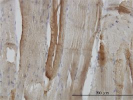 Carbonic Anhydrase III antibody (ab54913) used in immunohistochemistry at 3ug/ml on formalin fixed and paraffin embedded human skeletal muscle.