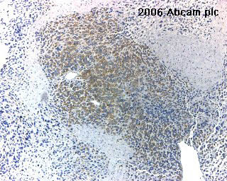 ab15086 at 1/500 staining dog gastric mucosa tissue sections by IHC-P. The tissue was formaldehyde fixed and a standard citrate buffer was used for anitgen retrieval. The tissue was blocked with 10% serum prior to incubation with the antibody for 15 hours. A biotinylated donkey anti-rabbit IgG (H + L) was used as the secondary.See Abreview
