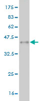 Western blot against tagged recombinant protein immunogen using ab54580 Carboxypeptidase A2 antibody at 1ug/ml.