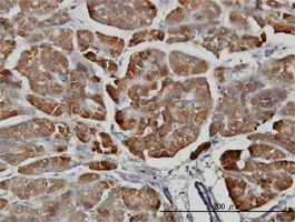 Carboxypeptidase B antibody (ab54581) used in immunohistochemistry at 3ug/ml on formalin fixed and paraffin embedded human pancreas.