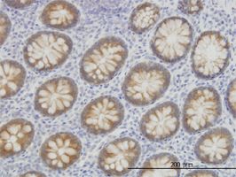 ACSL5 antibody (ab57210) used in immunohistochemistry at 3ug/ml on formalin fixed and paraffin embedded human colon.