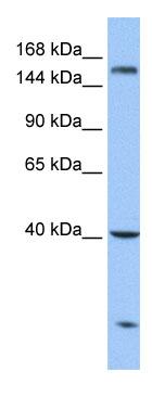 Anti-Carboxypeptidase D antibody (ab75140) at 1 µg/ml + HeLa cell lysate at 10 µgSecondaryHRP conjugated anti-Rabbit IgG at 1/50000 dilution