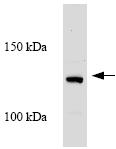 Anti-CARD10 antibody (ab64171) at 1/200 dilution + Jurkat whole cell lysate at 15 µg