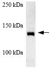 Anti-CARD11 antibody (ab64167) at 1/200 dilution + Mouse Thymus whole cell lysate at 15 µg