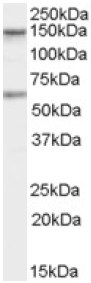 Anti-CARD11 antibody (ab4358) at 1 µg/ml + Human Jurkat cells (RIPA buffer, 35µg total protein per lane)