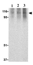 Lane 1 :  Anti-CARD12 antibody (ab21301) at 0.5 µg/mlLane 2 :  Anti-CARD12 antibody (ab21301) at 1 µg/mlLane 3 :  Anti-CARD12 antibody (ab21301) at 2 µg/mlLane 1 : Human PBL lysate 15ugLane 2 : Human PBL lysate 15ugLane 3 : Human PBL lysate 15ug