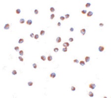 Immunocytochemical analysis of Jurkat cells labeling CARD15 using ab188646 at 5 µg/ml.