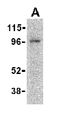 Anti-CARD15 antibody (ab36836) at 2 µg/ml + HeLa cell lysate