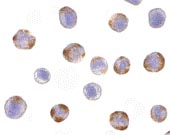 ab36836 at 10µg/ml staining CARD15 in Hela cells by Immunocytochemistry.
