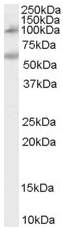 Anti-CARD15 antibody (ab53518) at 0.1 µg/ml + Human Peripheral Blood Mononucleocyte lysate (35µg protein in RIPA buffer).