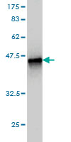 Western blot against tagged recombinant protein immunogen using ab57856 CARD6 antibody at 1ug/ml.