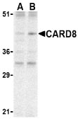 Lane 1 :  Anti-CARD8 antibody (ab24186) at 2 µg/ml (CARD8 expression in K562 cell lysate)Lane 2 :  Anti-CARD8 antibody (ab24186) at 4 µg/ml (CARD8 expression in K562 cell lysate)Lane 1 : As aboveLane 2 : As above