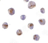 ab24186 at 10µg/ml staining CARD8 in K562 cells by ICC/IF