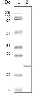 All lanes : Anti-Cardiac Troponin C antibody [3A10A12] (ab31980)Lane 1 : Molecular weight markerLane 2 : Truncated recombinant human cardiac troponin C protein