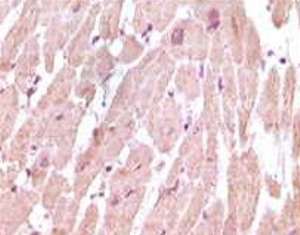 Immunohistochemical analysis of paraffin-embedded human normal cardiac muscle tissue, showing cytoplasmic localisation using anti-human cardiac troponin C antibody (ab31980) dilution 1:500-2000 and an HRP-conjugated secondary antibody with DAB staining.