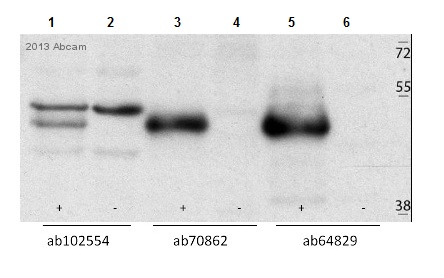 Lanes 1 - 2 : Anti-Casein Kinase 1 gamma 2 antibody (ab102554)Lanes 3 - 4 : Anti-Casein Kinase 1 gamma 2 antibody - C-terminal (ab70862) at 1/200 dilutionLanes 5 - 6 : Anti-Casein Kinase 1 gamma 2 antibody (ab64829) at 1/500 dilutionLane 1 : U2OS cells transfected with a plasmid expressing FLAG-tagged CK1G2Lane 2 : U2OS cells transfected with a plasmid expressing FLAG onlyLane 3 : U2OS cells transfected with a plasmid expressing FLAG-tagged CK1G2Lane 4 : U2OS cells transfected with a plasmid expressing FLAG onlyLane 5 : U2OS cells transfected with a plasmid expressing FLAG-tagged CK1G2Lane 6 : U2OS cells transfected with a plasmid expressing FLAG onlyLysates/proteins at 90 µg per lane.SecondaryHRP- conjugated Goat anti-rabbit polyclonal at 1/10000 dilutiondeveloped using the ECL technique