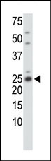 Anti-Casein Kinase 2 beta antibody (ab38177) at 1/100 dilution + HL-60 cell lysate