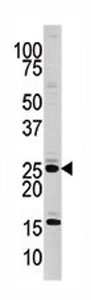 Anti-Casein Kinase 2 beta antibody - Aminoterminal end (ab71599) at 1/60 dilution + mouse kidney tissue lysate at 35 µg