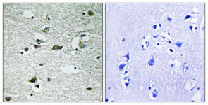 ab111431, at 1/50 dilution, staining Casein kinase I isoforms gamma 1+2+3 in paraffin-embedded Human brain tissue by Immunohistochemistry, in the presence (right panel) or absence (left panel) of immunising peptide.