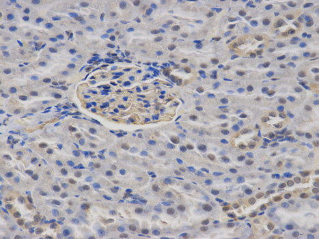 Immunohistochemistry (Formalin/PFA-fixed paraffin-embedded sections) analysis of rat kidney tissue labelling CASK with ab185932 at 1/100. Magnification: 400x.