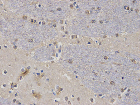 Immunohistochemistry (Formalin/PFA-fixed paraffin-embedded sections) analysis of rat brain tissue labelling CASK with ab185932 at 1/100. Magnification: 400x.