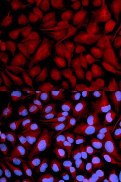 Immunocytochemistry/Immunofluorescence analysis of U2OS cells using ab185932. Blue DAPI for nuclear staining.