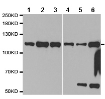 All lanes : Anti-CASK antibody (ab185932) at 1/500 dilutionLane 1 : 293T cell line extractLane 2 : U251 cell line extractLane 3 : BxPC3 cell line extractLane 4 : 22RV1 cell line extractLane 5 : H460 cell line extractLane 6 : A549 cell line extract