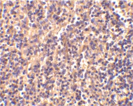 ab25897 at 2µg/ml staining Caspase 4 in human spleen tissue by IHC