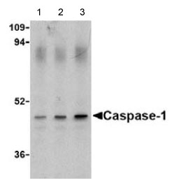 Lane 1 :  Anti-Caspase-1 antibody (ab62399) at 0.5 µg/mlLane 2 :  Anti-Caspase-1 antibody (ab62399) at 1 µg/mlLane 3 :  Anti-Caspase-1 antibody (ab62399) at 2 µg/mlLane 1 : HeLa cell lysateLane 2 : HeLa cell lysateLane 3 : HeLa cell lysate