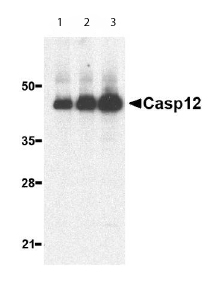 Lane 1 :  Anti-Caspase-12 antibody (ab62484) at 0.5 µg/mlLane 2 :  Anti-Caspase-12 antibody (ab62484) at 1 µg/mlLane 3 :  Anti-Caspase-12 antibody (ab62484) at 2 µg/mlLane 1 : Human heart lysateLane 2 : Human heart lysateLane 3 : Human heart lysateLysates/proteins at 15 µg per lane.SecondaryAnti rabbit IgG secondary antibody