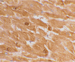 Immunohistochemical staining of human heart tissue using ab62484 antibody at 2 µg/ml.