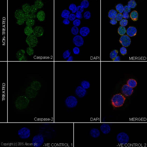 Immunofluorescent analysis of 4% paraformaldehyde-fixed, 0.1% Triton X-100 permeabilized Jurkat (Human T cell leukemia cells from peripheral blood) cells, untreated or treated with etoposide (30ug/ml) for 8 hours, labeling Caspase-2 with ab202420 at 1/500 dilution, followed by Goat anti-rabbit IgG (Alexa Fluor® 488) (ab150077) secondary antibody at 1/500 dilution (green). Confocal image showing nuclear and cytoplasmic staining on Jurkat cell line. The expression decreased after treatment with etoposide (30ug/ml) for 8 hours. The nuclear counter stain is DAPI (blue). Tubulin is detected with ab7291 (anti-Tubulin mouse mAb) at 1/1000 dilution and ab150120 (AlexaFluor®594 Goat anti-Mouse secondary) at 1/500 dilution (red).The negative controls are as follows:-ve control 1: ab202420 at 1/500 dilution followed by ab150120 (AlexaFluor®594 Goat anti-Mouse secondary) at 1/500 dilution.-ve control 2: ab7291 (anti-Tubulin mouse mAb) at 1/1000 dilution followed by ab150077 (Alexa Fluor®488 Goat