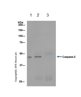 Caspase-2 was immunoprecipitated from 1mg of HEK-293 (Human epithelial cells from embryonic kidney) whole cell lysate with ab202420 at 1/100 dilution. Western blot was performed from the immunoprecipitate using ab202420 at 1/2000 dilution. Anti-Rabbit IgG (HRP), specific to the non-reduced form of IgG, was used as secondary antibody at 1/1500 dilution.Lane 1: HEK-293 whole cell lysate 10 µg (Input). Lane 2: ab202420 IP in HEK-293 whole cell lysate. Lane 3: Rabbit monoclonal IgG (ab172730) instead of ab202420 in HEK-293 whole cell lysate.Blocking and dilution buffer and concentration: 5% NFDM/TBST.Exposure time: 10 seconds.