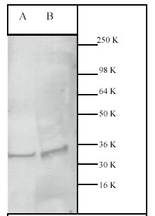ab7980 at a 1:200 dilution staining Caspase 3 in Jurkat whole cell lysate (lane A) and SK-BR-3 whole cell lystae (lane B).   ab7980 at a 1:200 dilution staining Caspase 3 in Jurkat whole cell lysate (lane A) and SK-BR-3 whole cell lystae (lane B). 