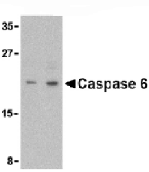 Lane 1 :  Anti-Caspase-6 antibody (ab62457) at 1 µg/mlLane 2 :  Anti-Caspase-6 antibody (ab62457) at 2 µg/mlLane 1 : MCF7 cell lysateLane 2 : MCF7 cell lysateLysates/proteins at 15 µg per lane.