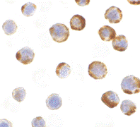 Immunocytochemistry of Caspase-6 in MCF7 with ab62457 at 1 µg/ml.