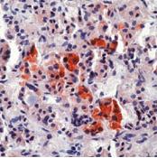 Anti ACTH, at 0.4 µg/ml, staining ACTH in formalin fixed, paraffin embedded human pituitary gland by Immunohistochemistry. Peroxidase conjugating and AEC chromogen were used. Note cytoplasmic staining of anterior pituitary cells. Note: Anti ACTH used to generate this image differed from ab76554 only due to the presence of BSA and azide.