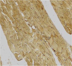 Immunohistochemical staining of human skeletal muscle (paraffin embedded sections) using ab25900 anti Caspase-7 at 2 µg/ml.