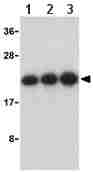 Lane 1 :  Anti-Caspase-8 antibody (ab25901) at 0.5 µg/mlLane 2 :  Anti-Caspase-8 antibody (ab25901) at 1 µg/mlLane 3 :  Anti-Caspase-8 antibody (ab25901) at 2 µg/mlLane 1 : Jurkat cell lysate.Lane 2 : Jurkat cell lysate.Lane 3 : Jurkat cell lysate.
