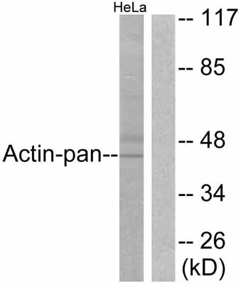 All lanes : Anti-Actin antibody (ab52220) at 1/500 dilutionLane 1 : HeLa cell extractLane 2 : HeLa cell extract with immunizing peptide