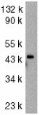 Anti-Caspase-9 antibody (ab2013) at 1/1000 dilution + HeLa whole cell lysate