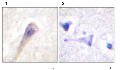 ab59429, at a 1/50 dilution, staining Catalase in paraffin embedded human brain tissue by Immunohistochemistry in the absence (left image) or presence (right image) of the phosphopeptide.