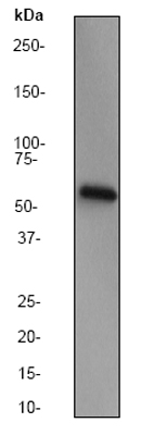 Anti-Catalase antibody (ab52477) at 1/1000 dilution + TF1 lysate at 10 µgSecondaryGoat anti-rabbit HRP labeled at 1/2000 dilution