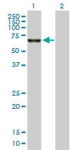 All lanes : Anti-Catalase antibody (ab88650) at 1 µg/mlLane 1 : cell lysate from Catalase transfected 293T cellsLane 2 : cell lysate from non transfected 293T cellsLysates/proteins at 25 µg per lane.developed using the ECL technique