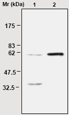 ab16772 at a 1µg/ml immunoprecipitating human Catalase in lane 2) from HeLa cell lysate. Ab16731 was used to stain the Western blot. Lane 1) is standard HeLa cell lysate (no immunoprecitation).